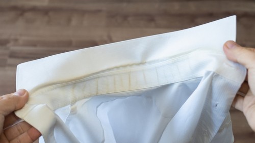 Frequently Asked Questions About Yellow Stains on White Clothes